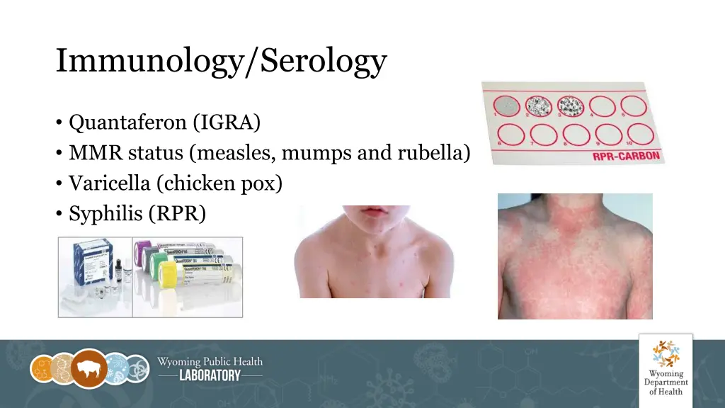 immunology serology 1