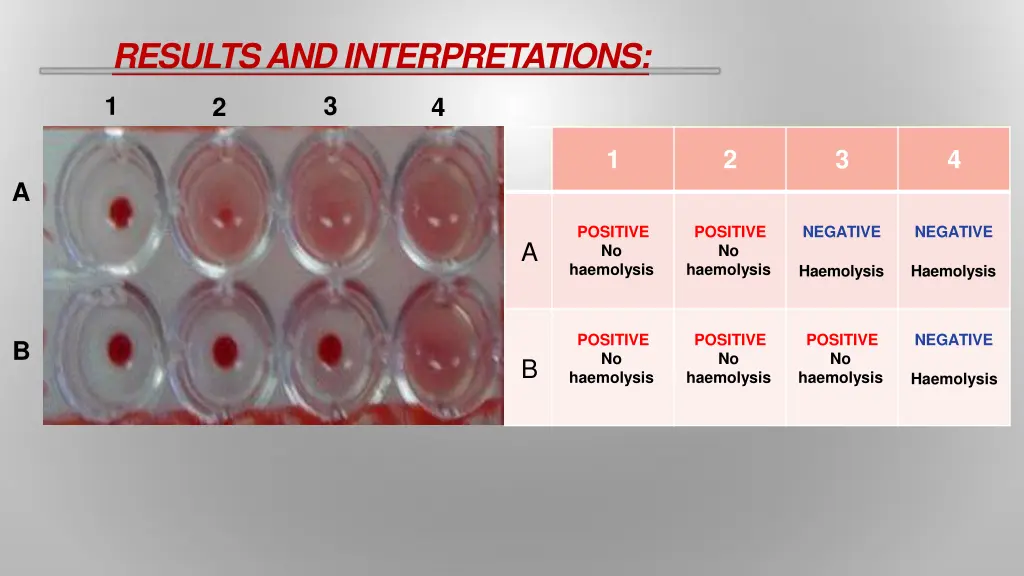 resultsand interpretations