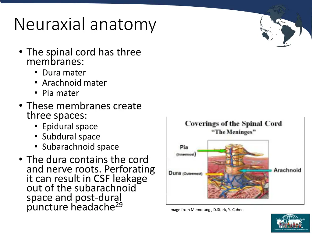 neuraxial anatomy