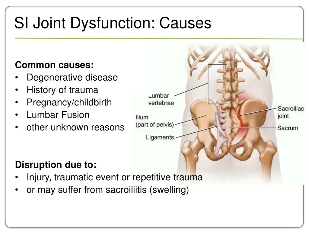 si joint dysfunction causes