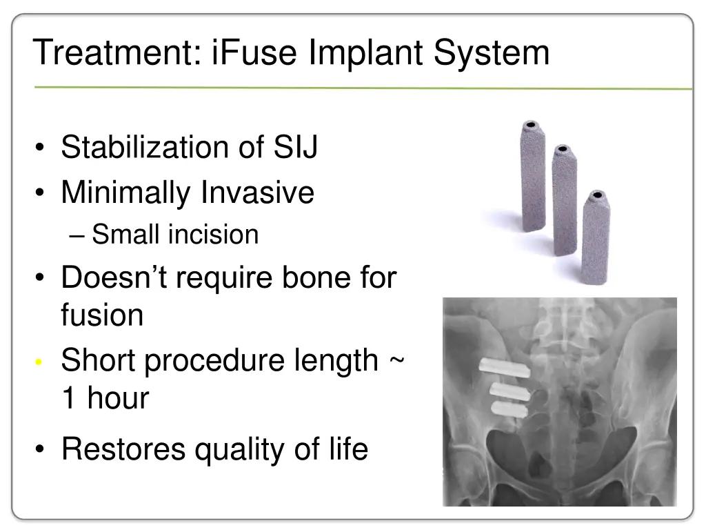 treatment ifuse implant system