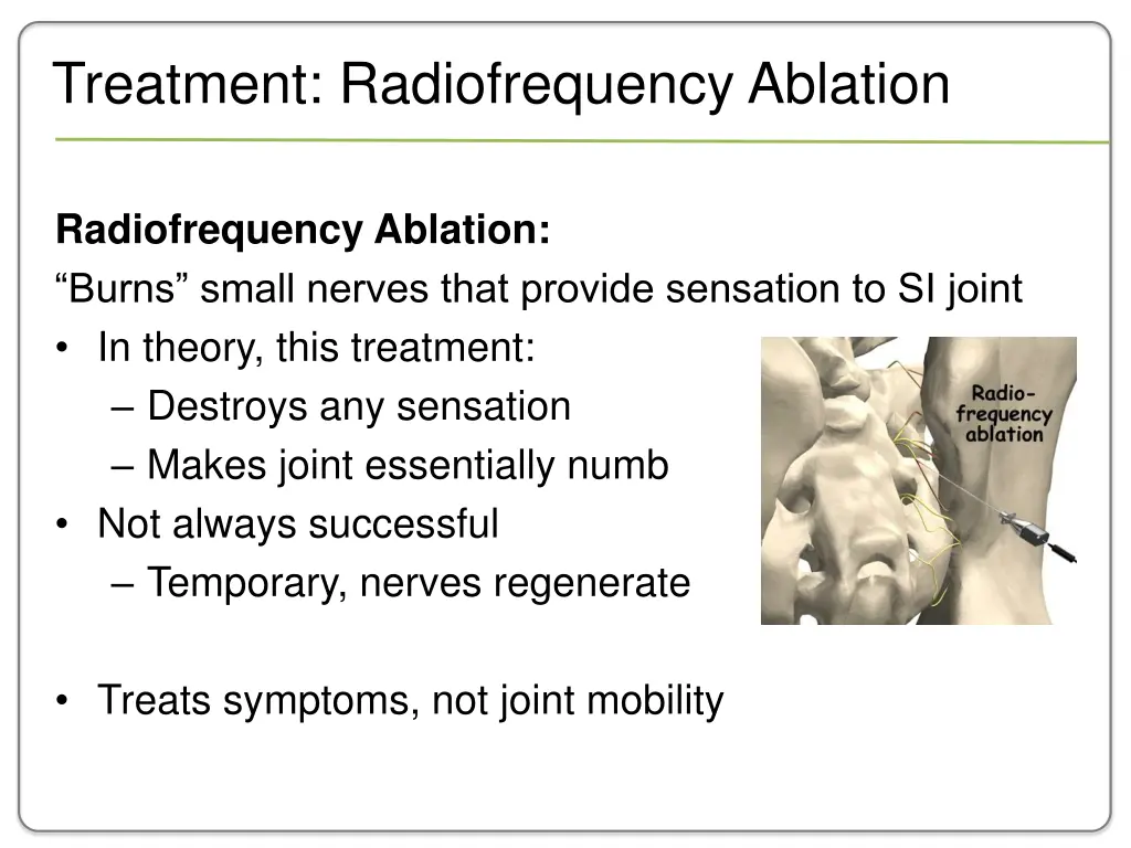 treatment radiofrequency ablation