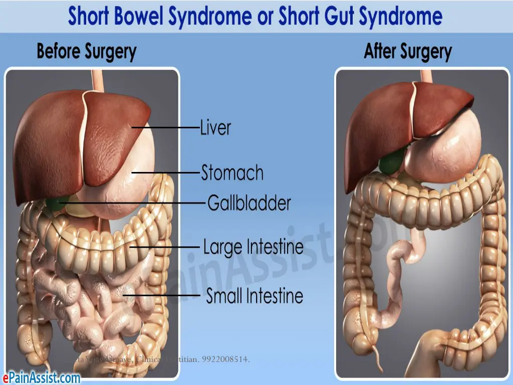 sucheta vijay limaye clinical dietitian 9922008514 1