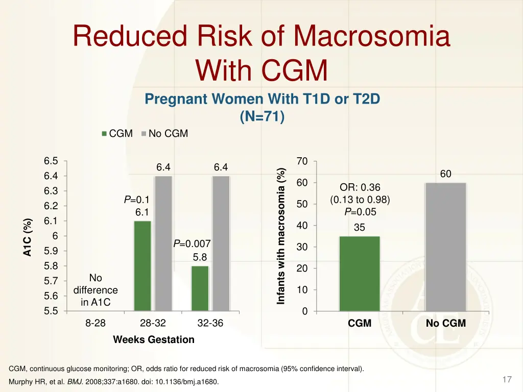 reduced risk of macrosomia with cgm pregnant