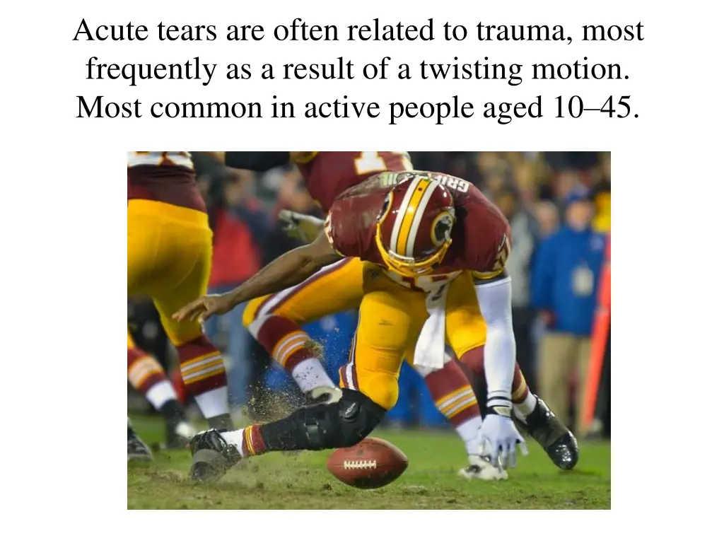 acute tears are often related to trauma most