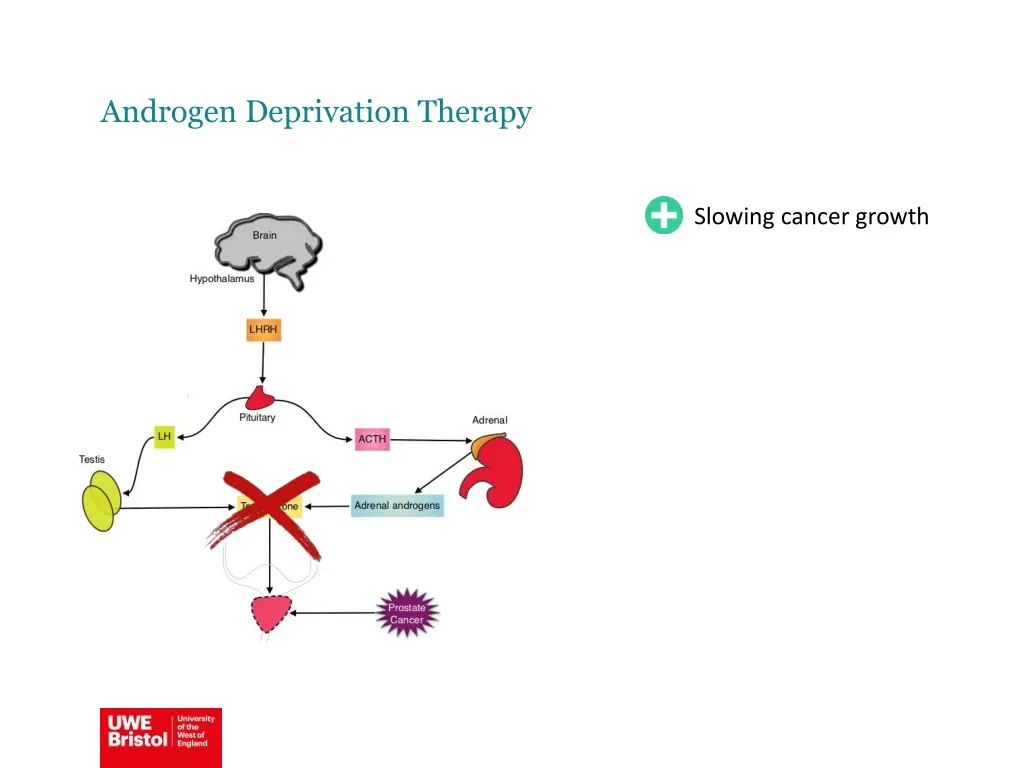 androgen deprivation therapy 2