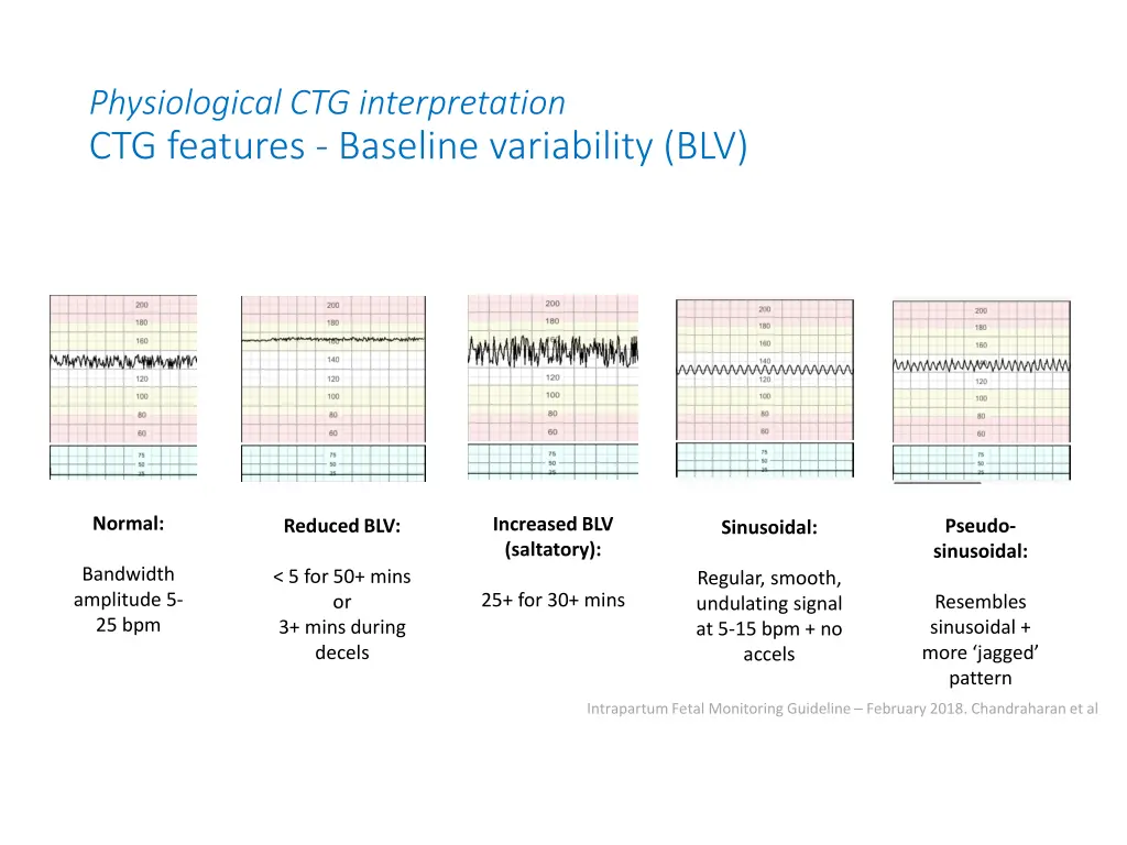 physiological ctg interpretation ctg features 1