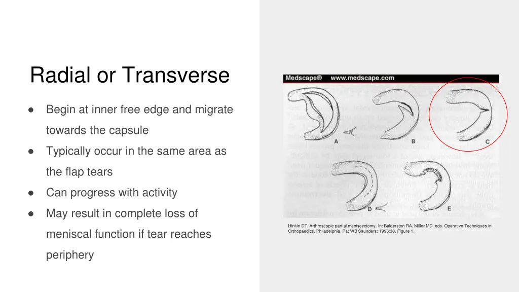 radial or transverse