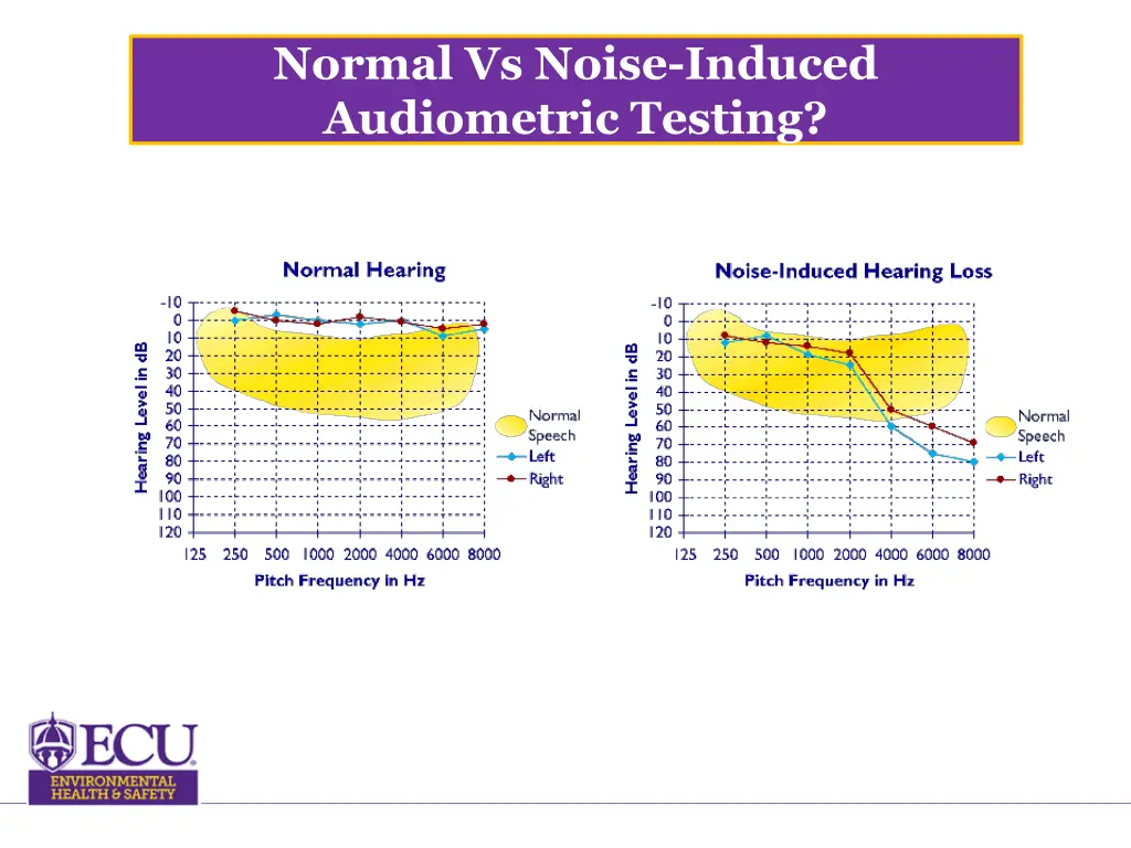 normal vs noise induced audiometric testing