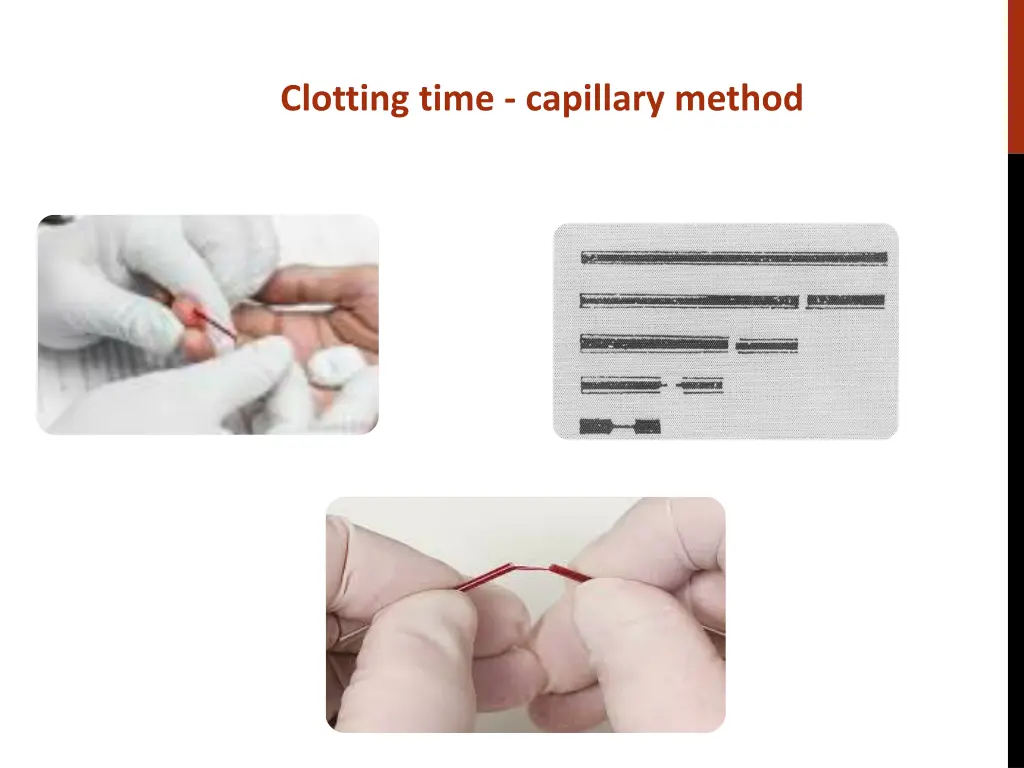 clotting time capillary method