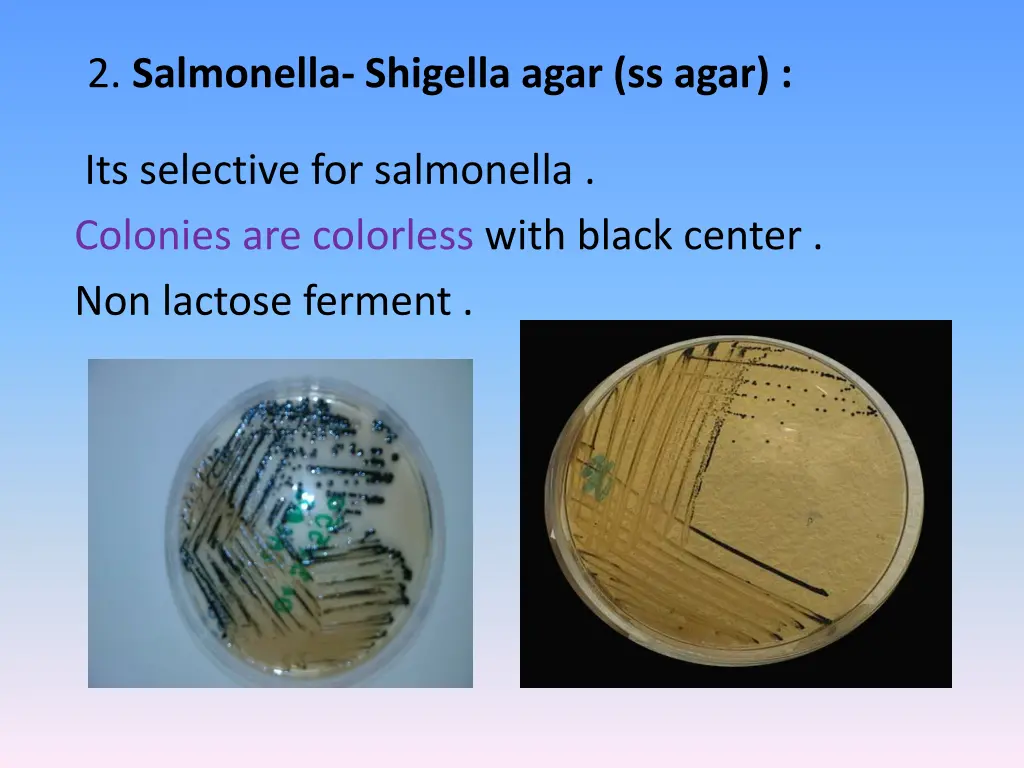 2 salmonella shigella agar ss agar