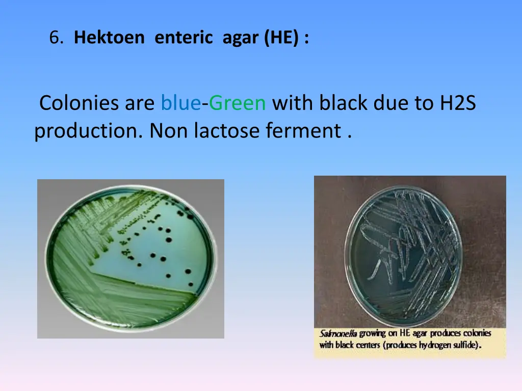 6 hektoen enteric agar he