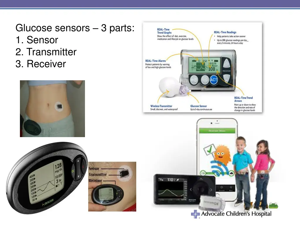 glucose sensors 3 parts 1 sensor 2 transmitter