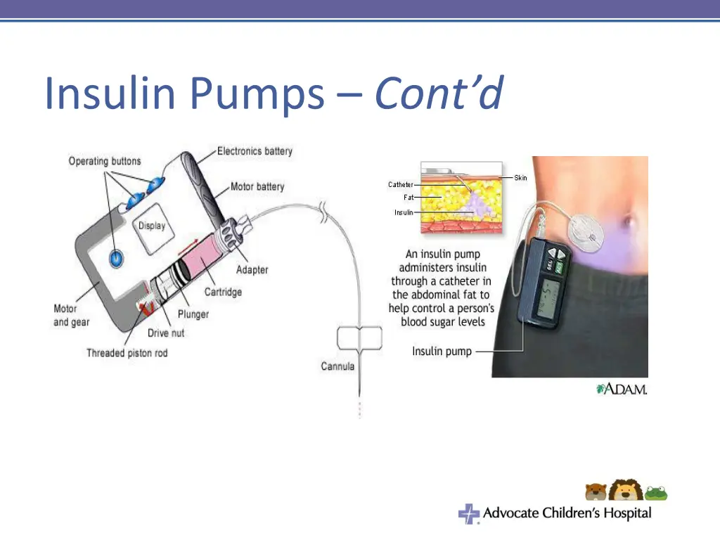 insulin pumps cont d