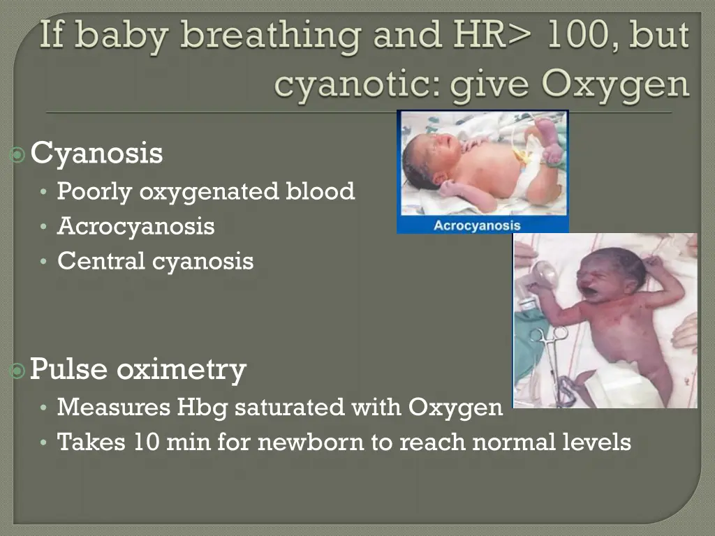 cyanosis poorly oxygenated blood acrocyanosis