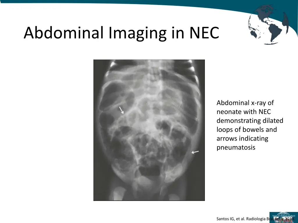 abdominal imaging in nec