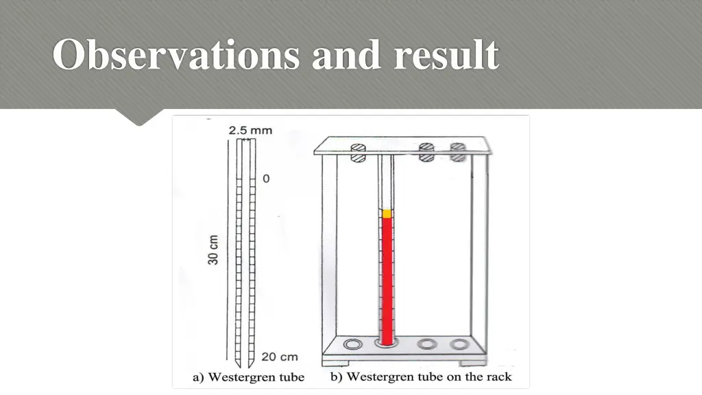 observations and result