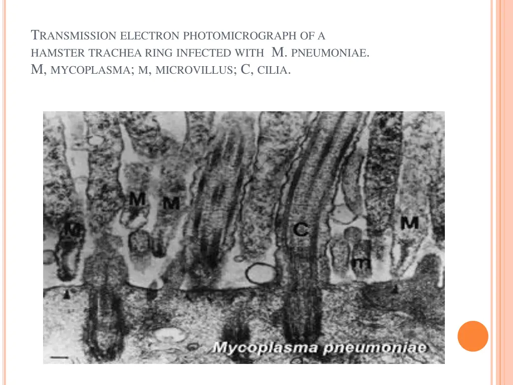 t ransmission electron photomicrograph