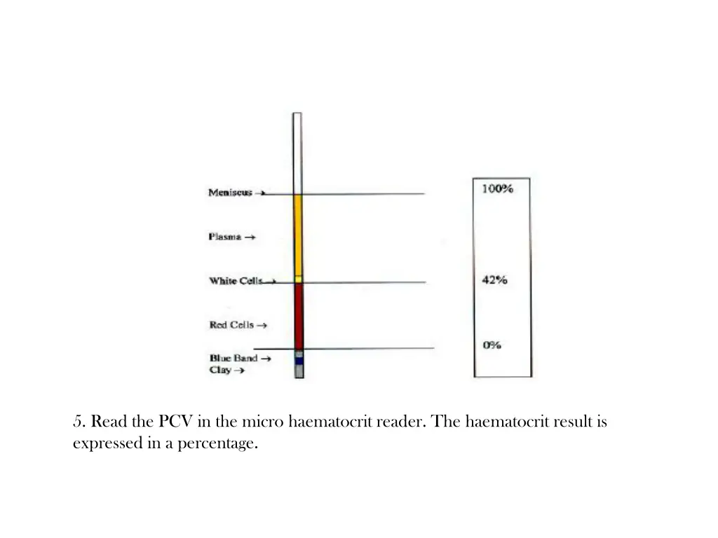 5 read the pcv in the micro haematocrit reader