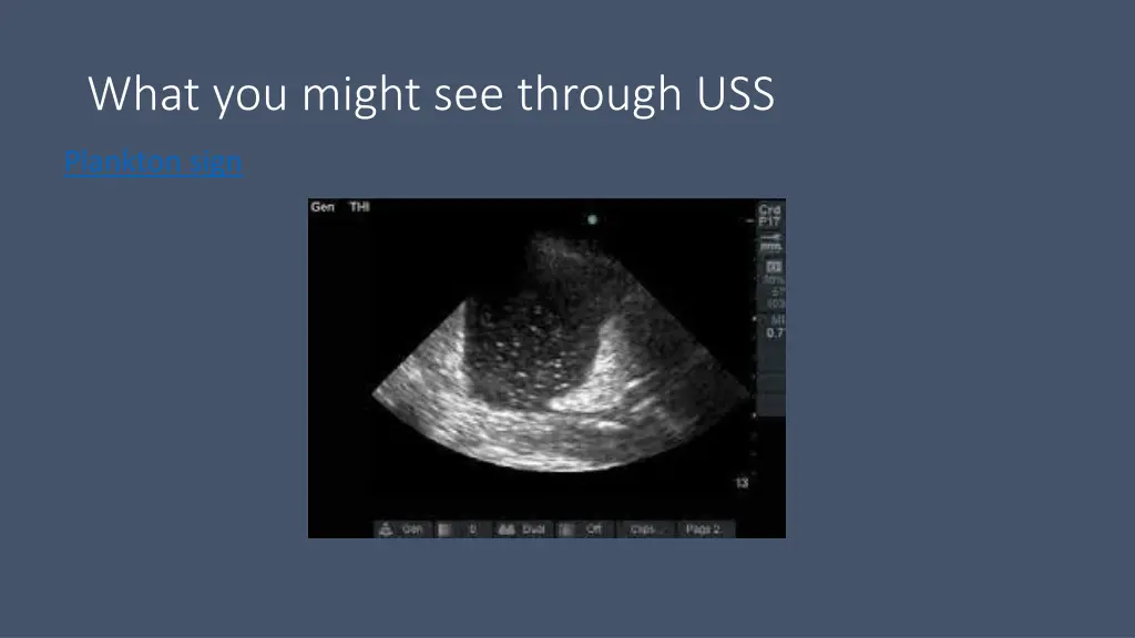 what you might see through uss 2