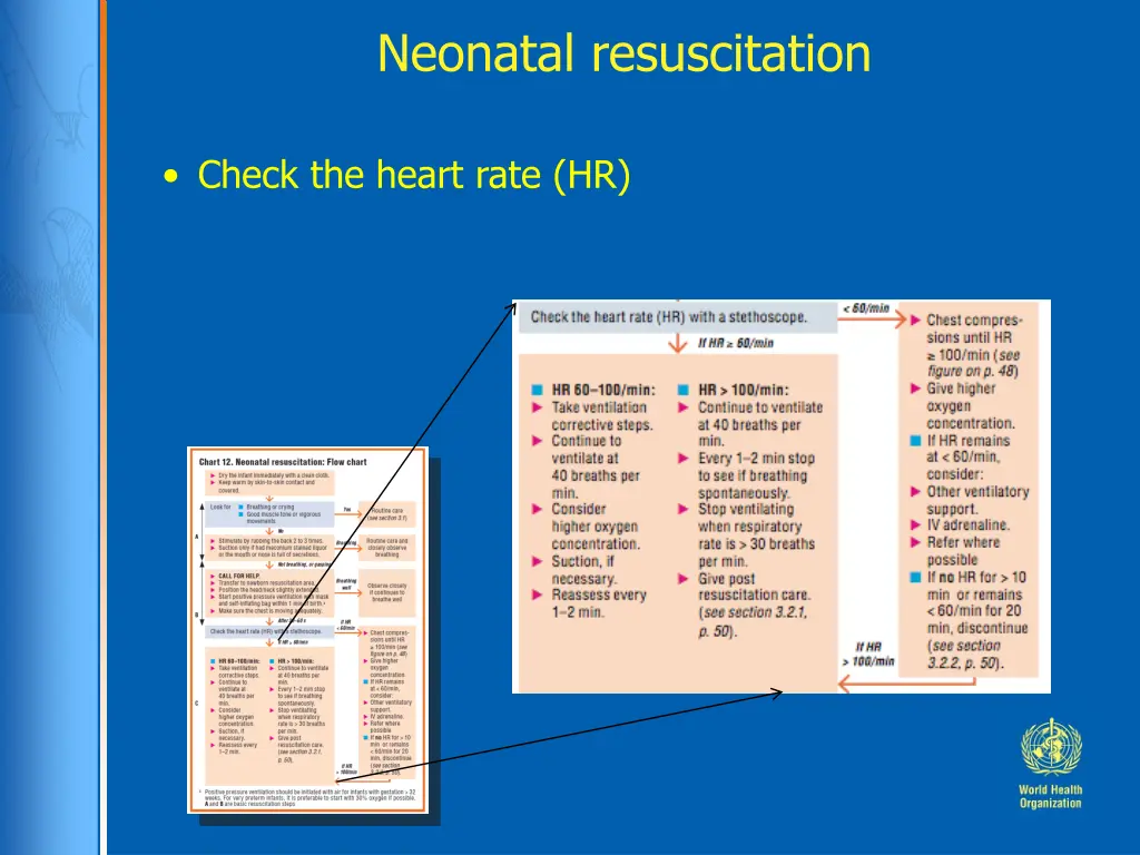 neonatal resuscitation 1