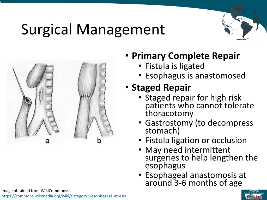 surgical management 1