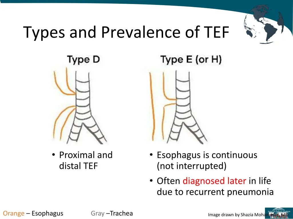 types and prevalence of tef 1