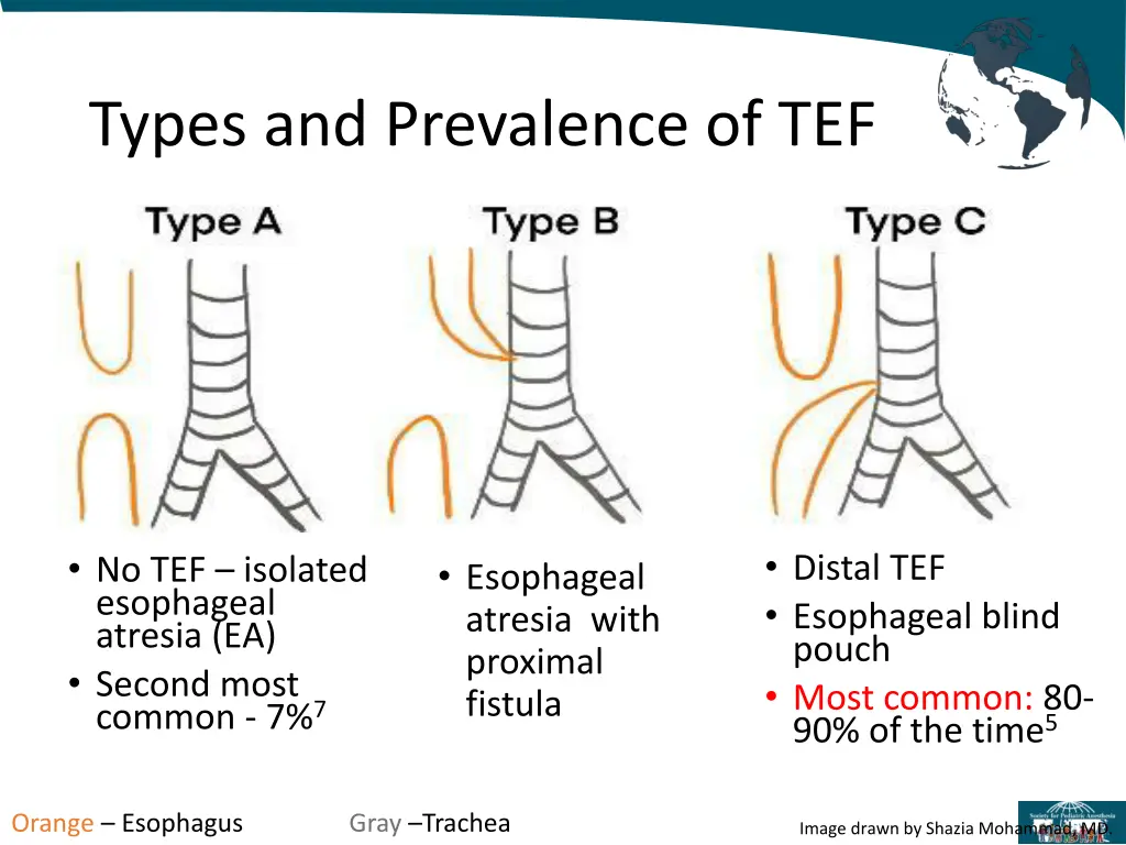 types and prevalence of tef