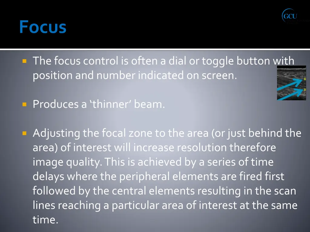 the focus control is often a dial or toggle