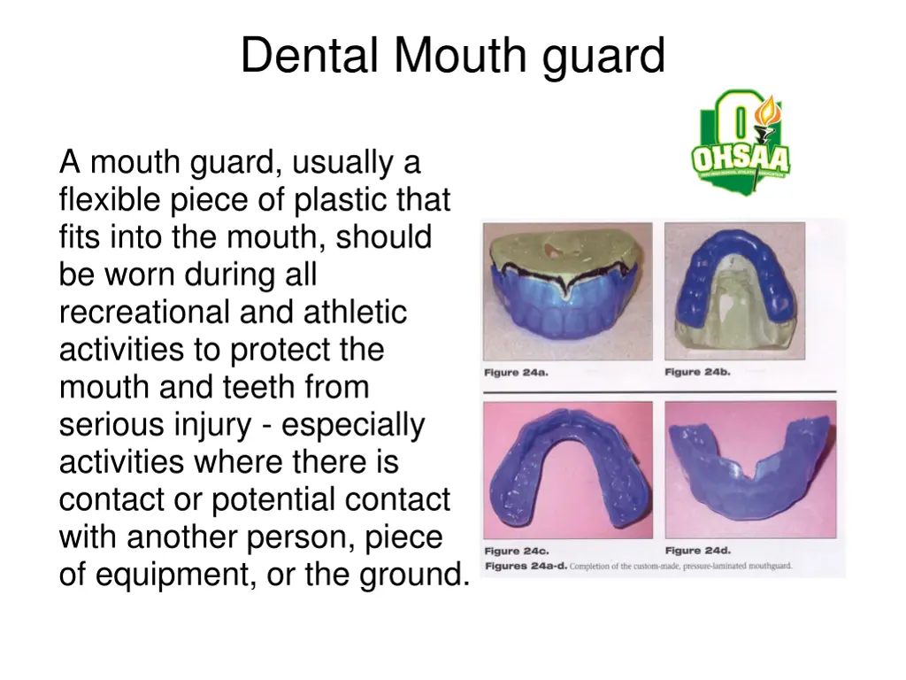 dental mouth guard