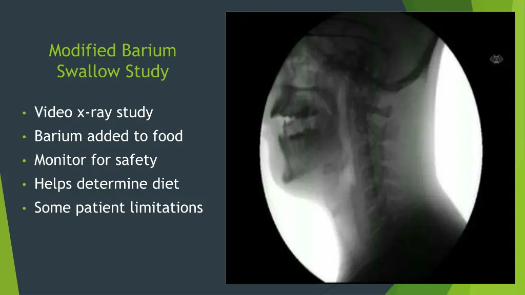 modified barium swallow study