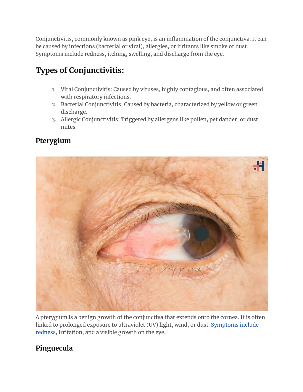 conjunctivitis commonly known as pink