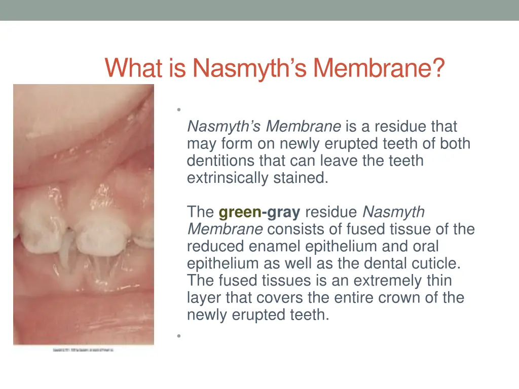 what is nasmyth s membrane