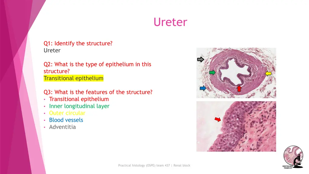 ureter