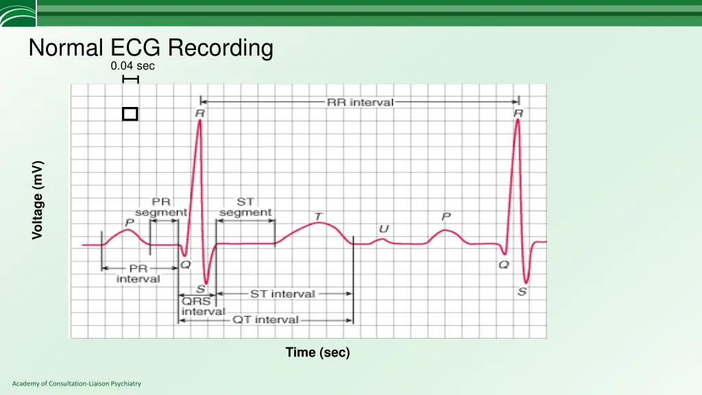 normal ecg recording 0 04 sec