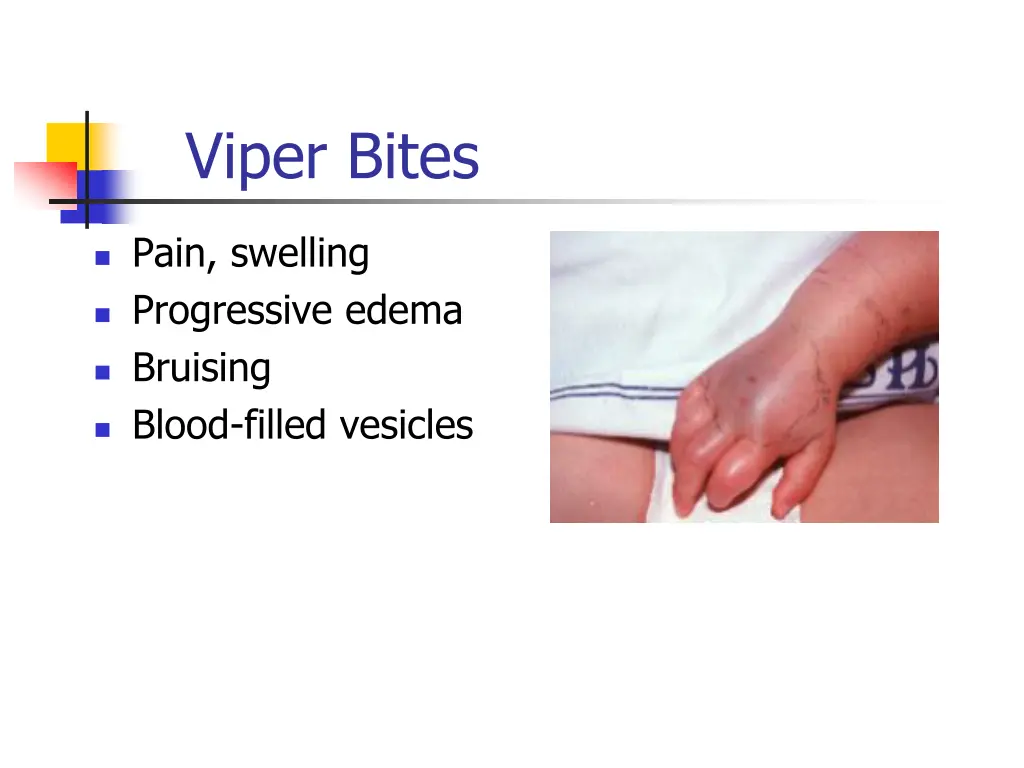 viper bites