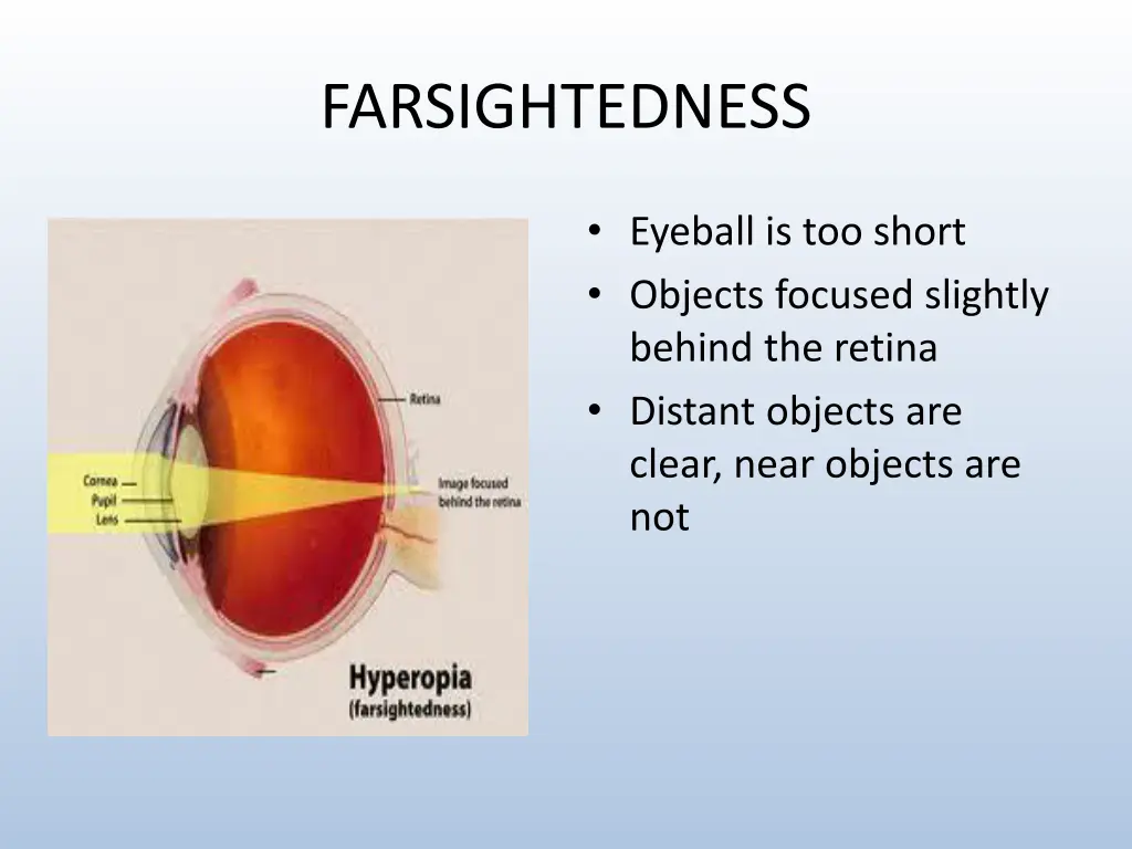 farsightedness