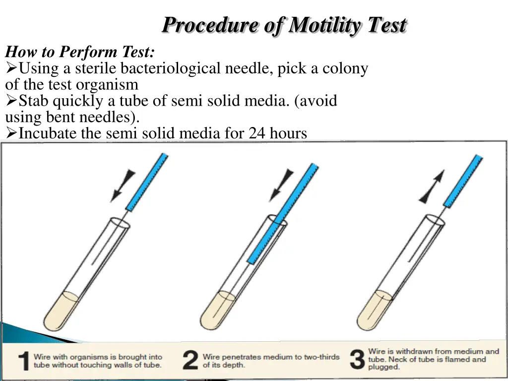 procedure of motility test