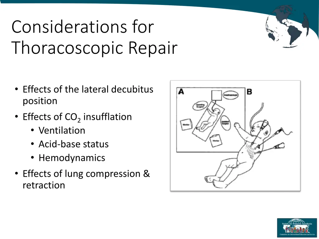 considerations for thoracoscopic repair