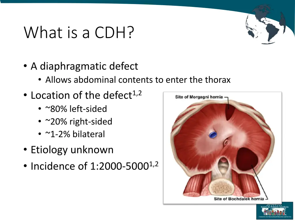 what is a cdh