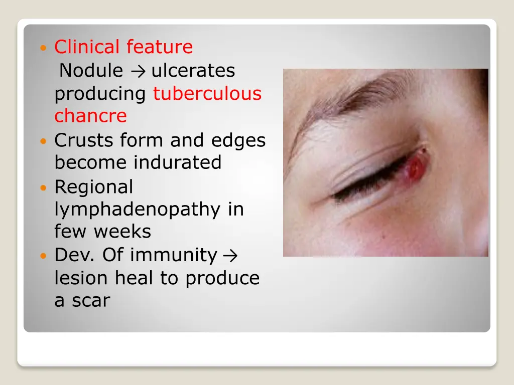 clinical feature nodule ulcerates producing