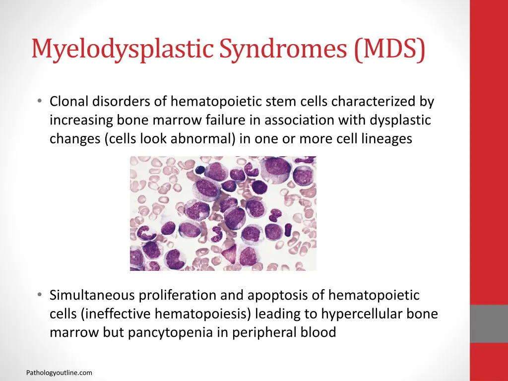 myelodysplastic syndromes mds