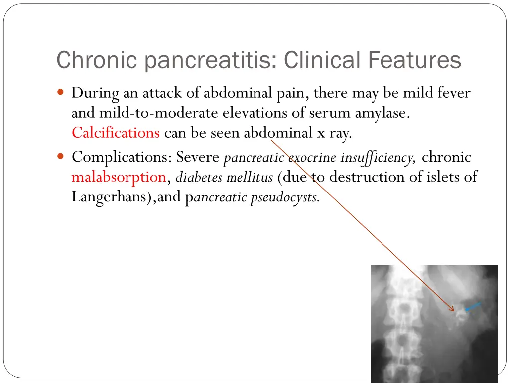 chronic pancreatitis clinical features 1