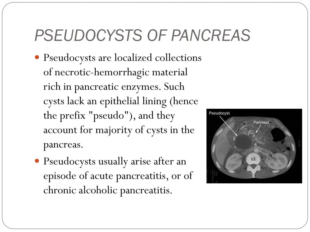 pseudocysts of pancreas