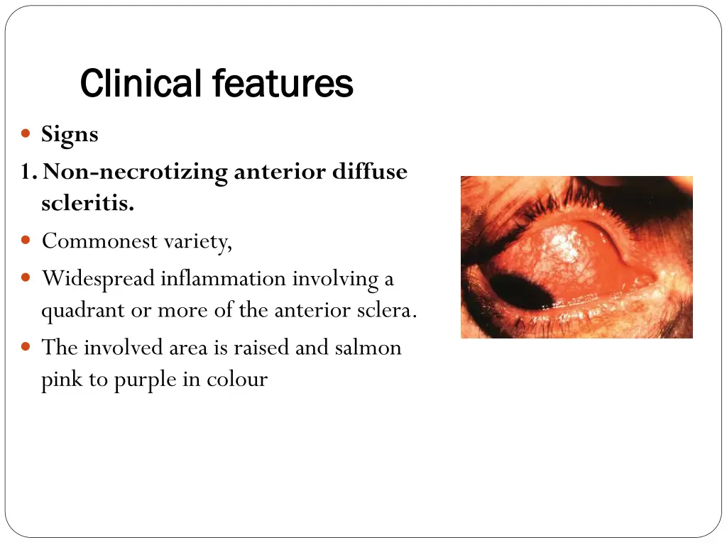 clinical features clinical features 1