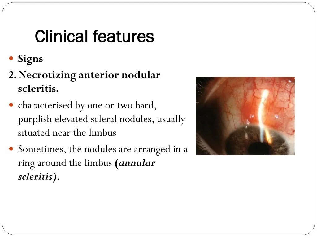 clinical features clinical features 2