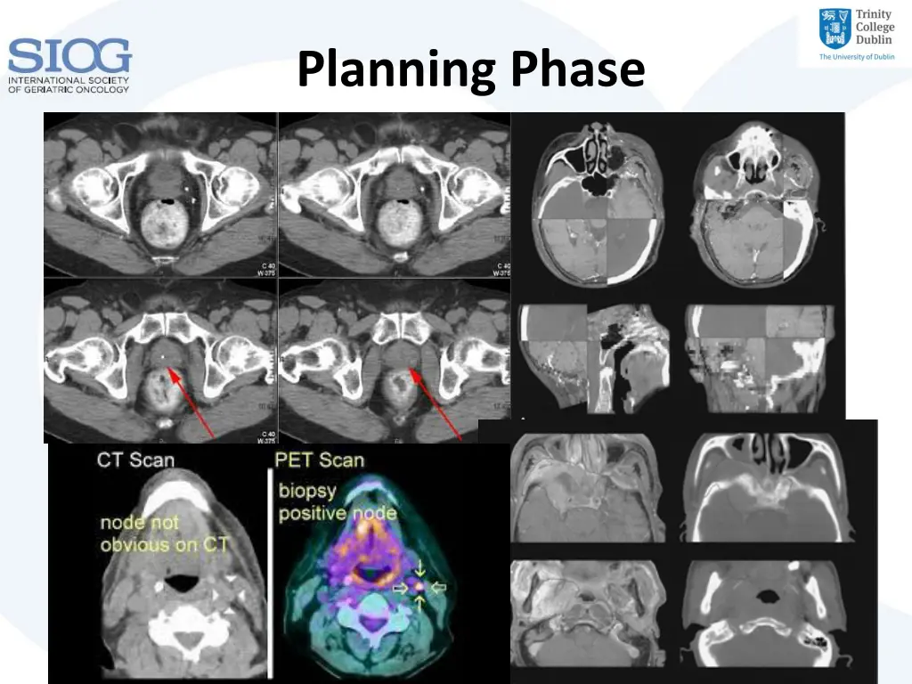 planning phase