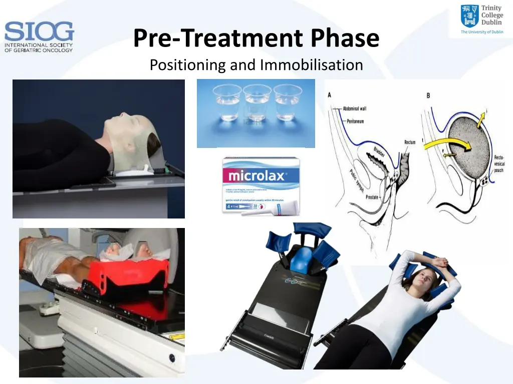 pre treatment phase positioning and immobilisation