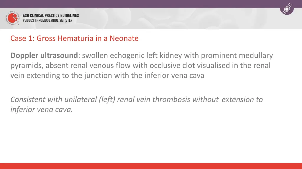 case 1 gross hematuria in a neonate 1