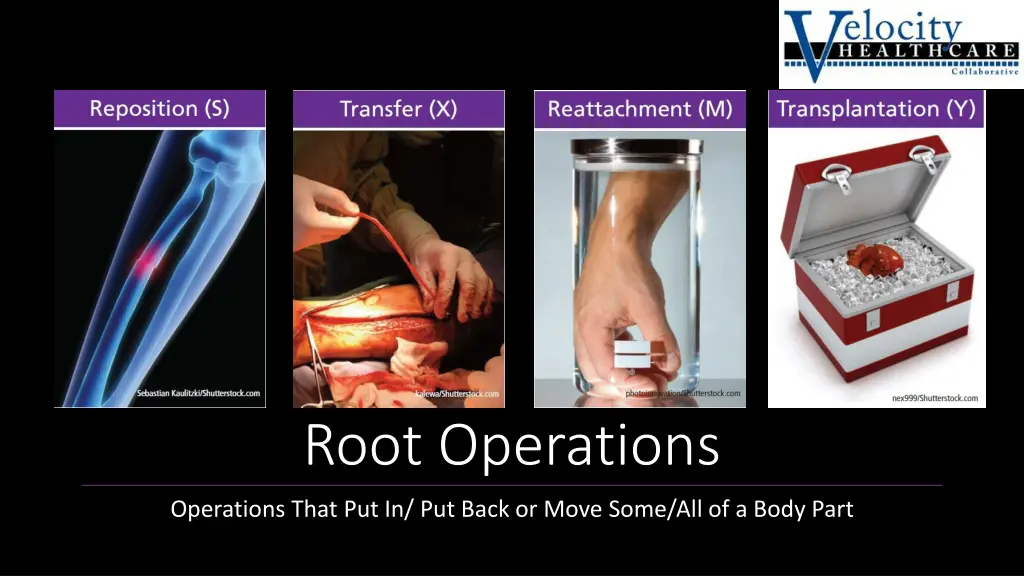 root operations 2